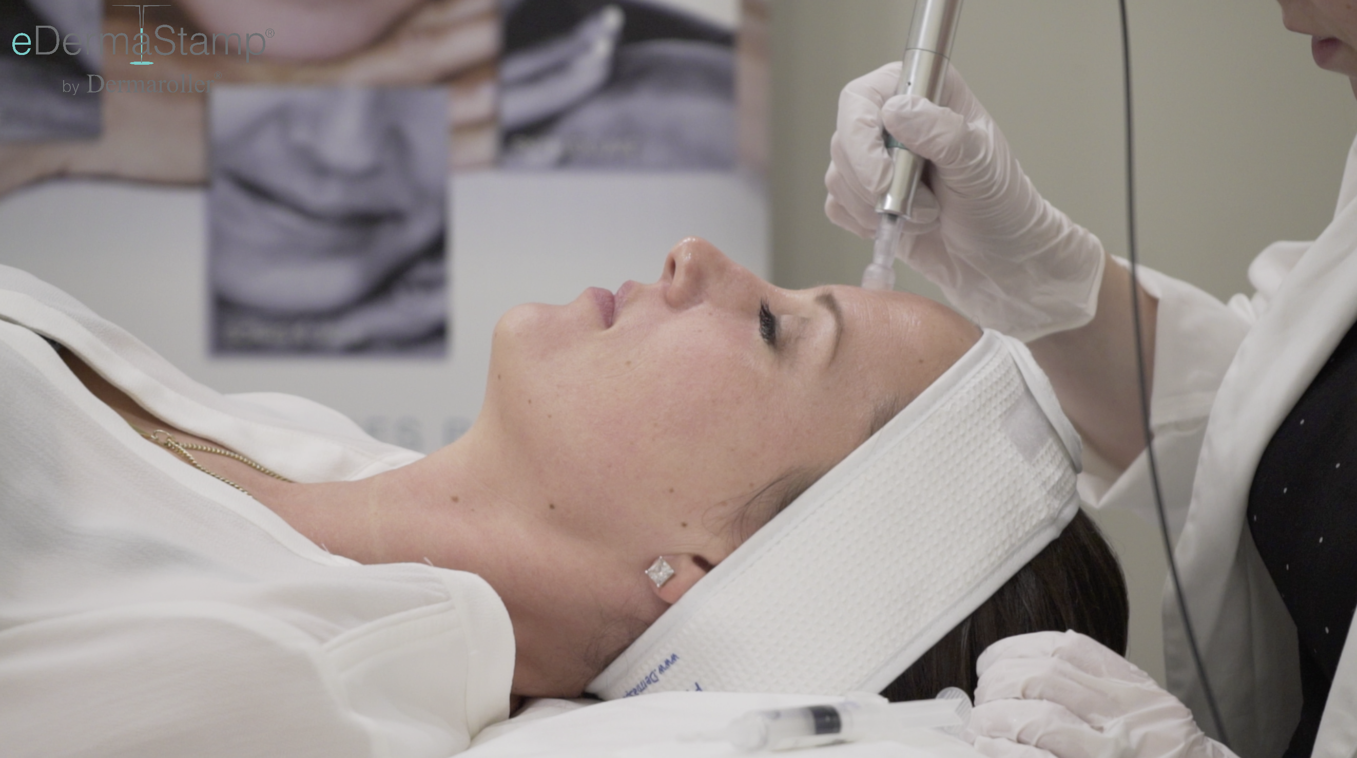 Dermal Pen : Collagen Induction Therapy