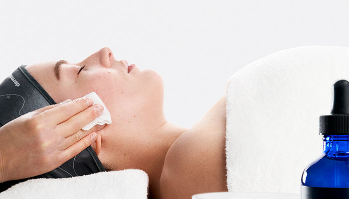 Chemical peels, what are they and how to use them