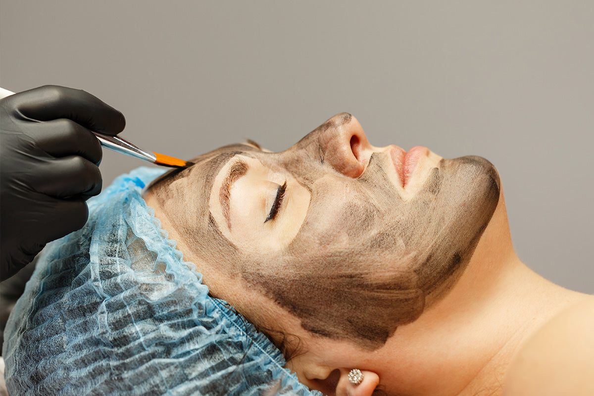 My Experience with the New Carbon Laser Facial