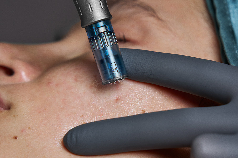 Meet the New Dermalogica Pro Pen 2: Advanced Microneedling at Skintopia