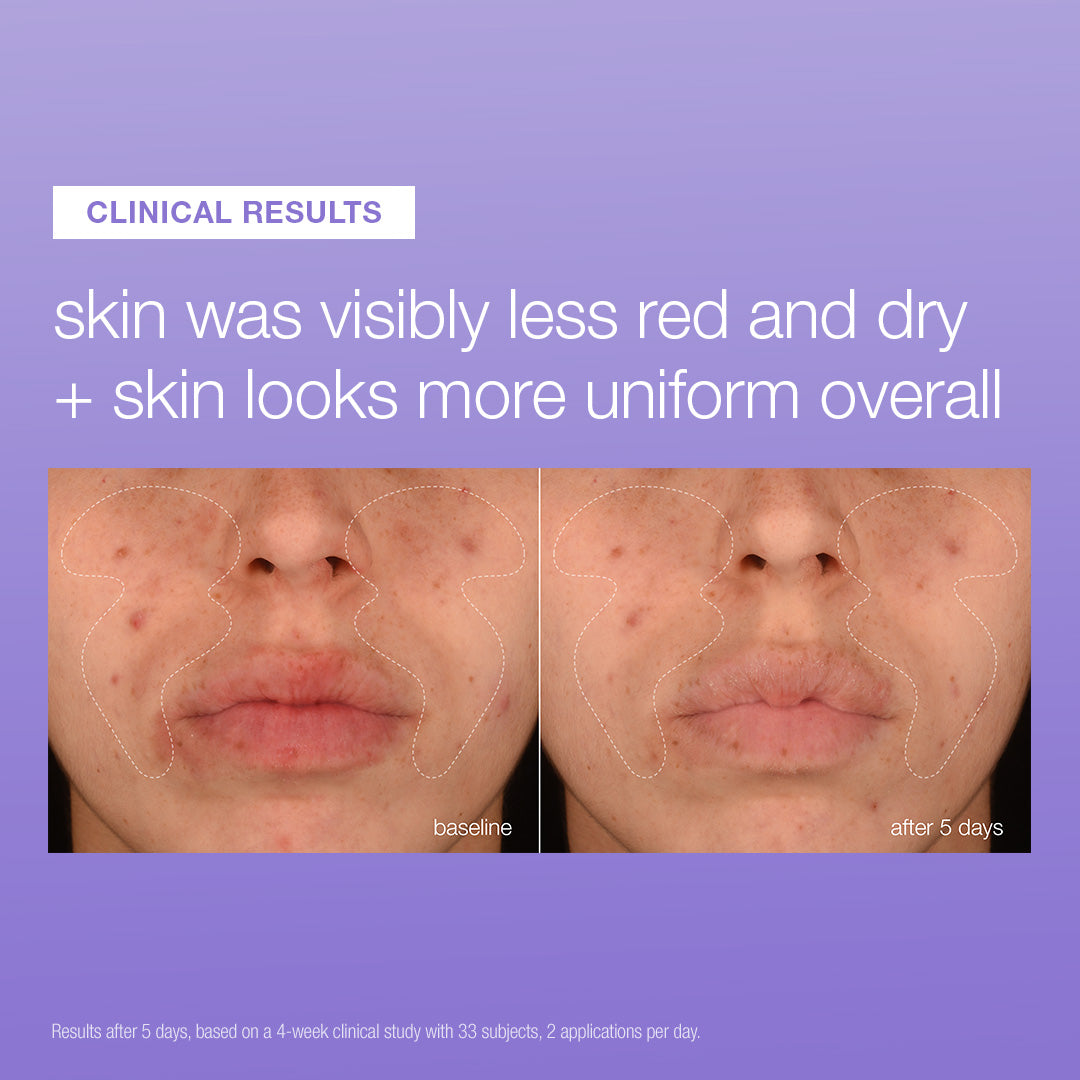 Stabilizing Repair Serum