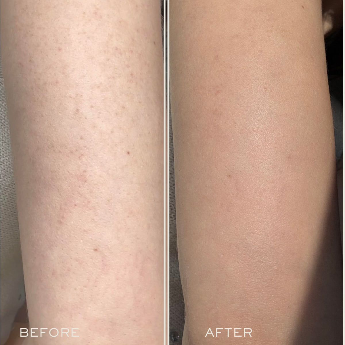 Exfoliating Body Serum